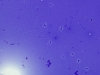 Filename=colloid_nodule-watery_colloid-dq-low-29-zhang.jpg
Filesize=98KiB
Dimensions=797x600
Date added=Sep 04, 2009 colloid_nodule-watery_colloid-dq-low-29-zhang.jpg