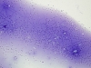 Filename=colloid_nodule-watery_colloid-dq-low-zhang-2.jpg
Filesize=156KiB
Dimensions=797x600
Date added=Sep 04, 2009 colloid_nodule-watery_colloid-dq-low-zhang-2.jpg
