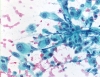 ATC40BB~0.JPG