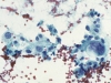 Filename=AUS_FLUS_scenario_7a_radioiodine.jpg
Filesize=509KiB
Dimensions=1000x753
Date added=Oct 28, 2010 AUS_FLUS_scenario_7a_radioiodine.jpg