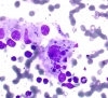 Hashimotos,_tingible_body_macrophage,_DQ_hp_SM.jpg