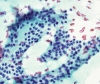MNG-_norm_foll_cells_shimmering_in_colloid,_PAP.jpg