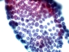 Pap-ptc-5.jpg
