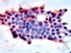 Filename=Susp_PTC-3.jpg
Filesize=122KiB
Dimensions=864x648
Date added=Apr 23, 2010 Susp_PTC-3.jpg
