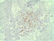 Fig 11